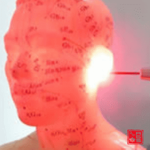 Laserterapia facial