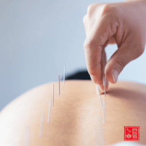 Tratamiento del dolor