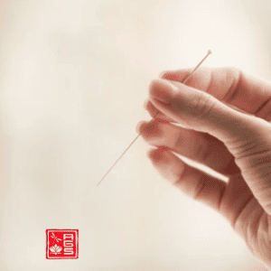 Acupuntura en Zaragoza